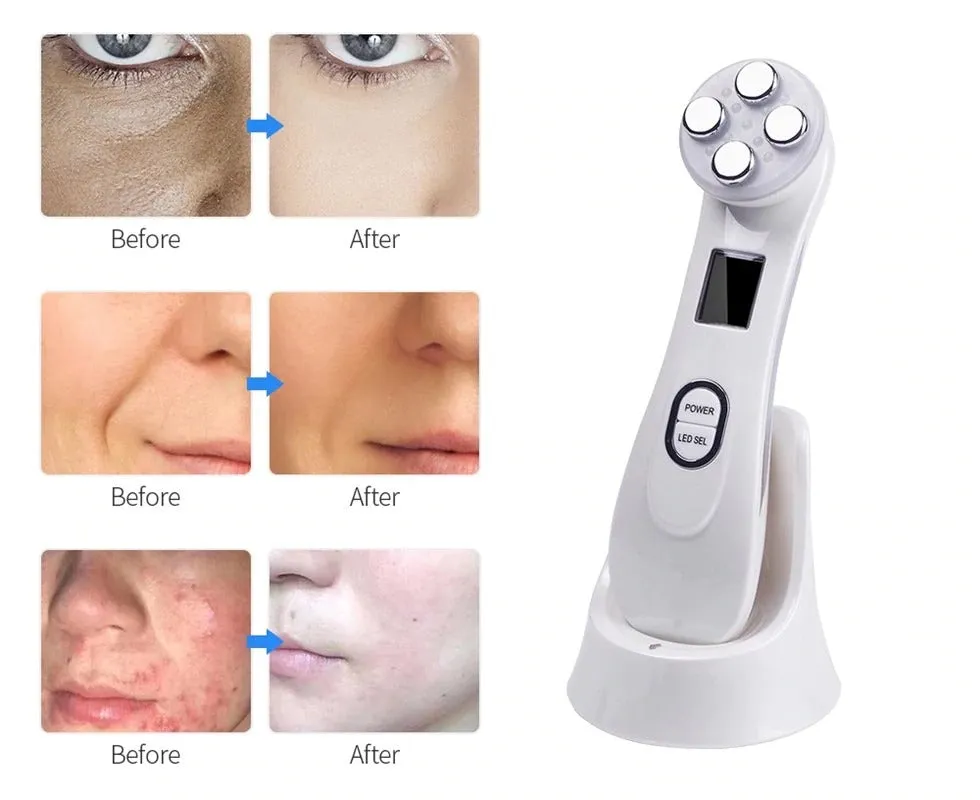 MLAY RF Radio Frequency Face Lifting Device & Wrinkle Remove, Skin Lifting